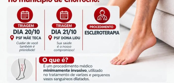 ATENDIMENTO DE ESCLEROTERAPIA EM CHORROCHÓ-BAHIA